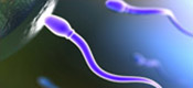Sperm
